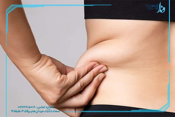 لاغری بدون عمل جراحی