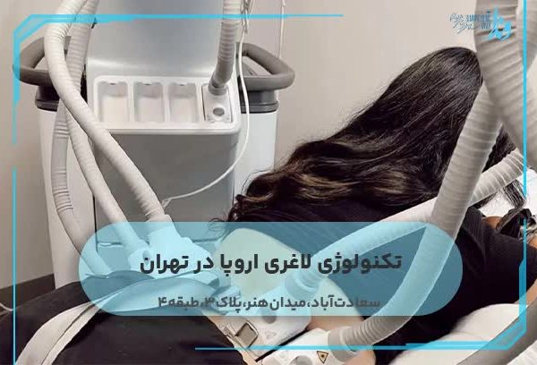 تکنولوژی لاغری اروپا در تهران