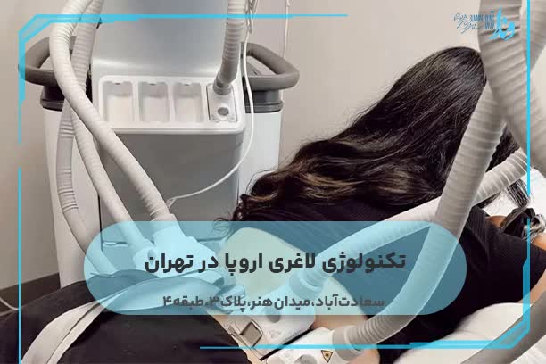 تکنولوژی لاغری اروپا در تهران