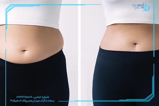 راحت ترین روش لاغری شکم راحت ترین روش لاغری شکم