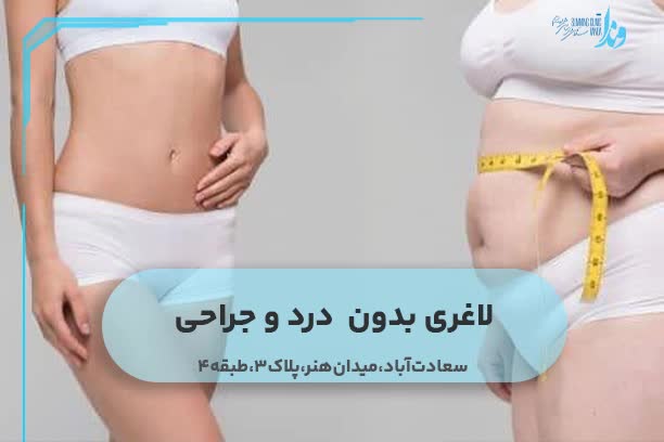 لاغری بدون درد و جراحی