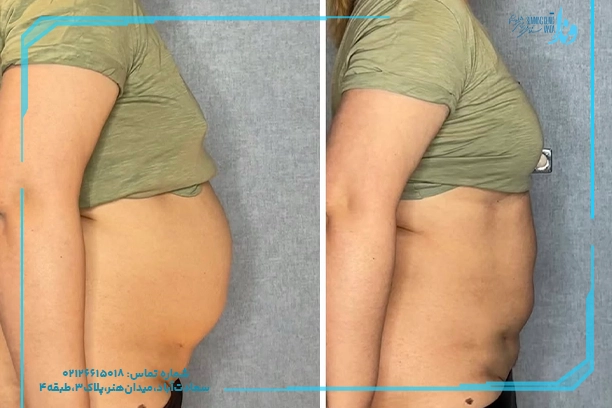 کلینیک لاغری بانوان در تهران