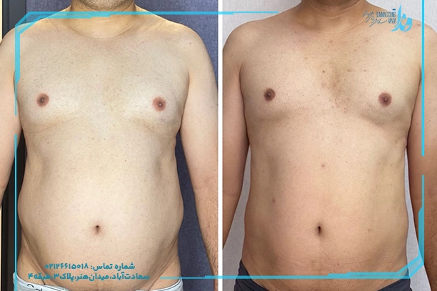 کاهش سایز بدون رژیم غذایی کاهش سایز بدون رژیم غذایی